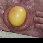 Anal games 427