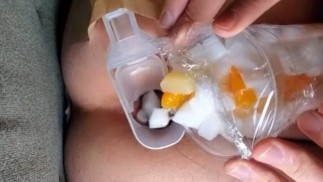 ANAL CHI ADORA COSE SWEET. DESSERT AGAR INSERT